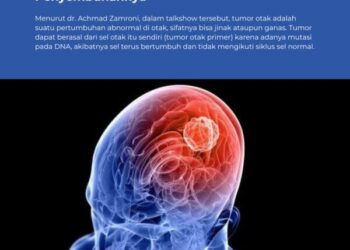 Pemkab Bojonegoro Ajak Warga Waspadai Tumor Otak Sejak Dini